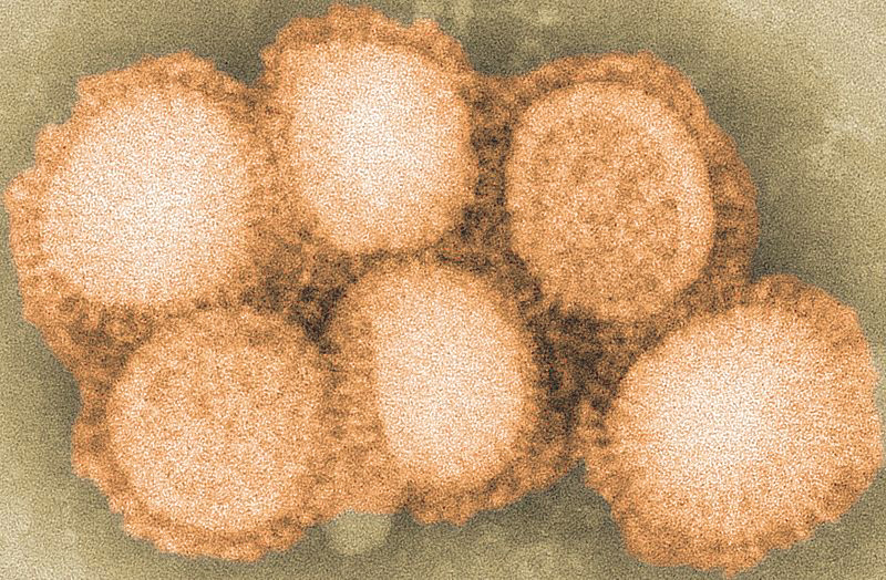 Elektronenmikroskopie von Influenzavirus-Partikeln