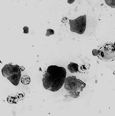 Mikroplastik